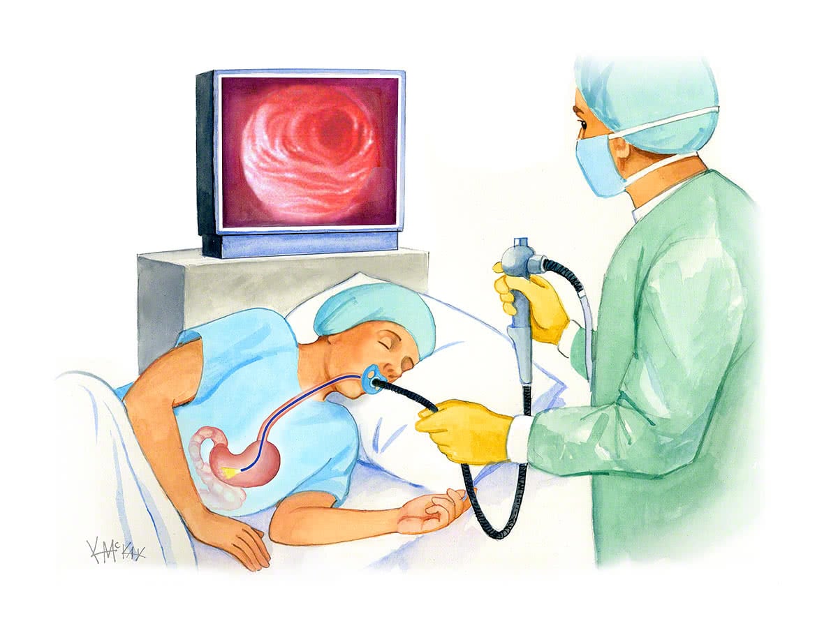 gastroscopy_u