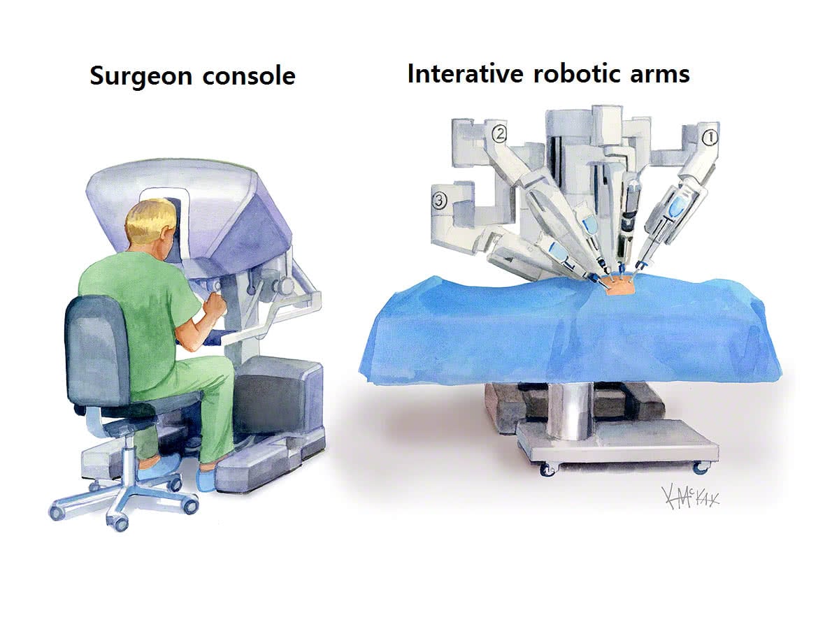 robotic-surgery